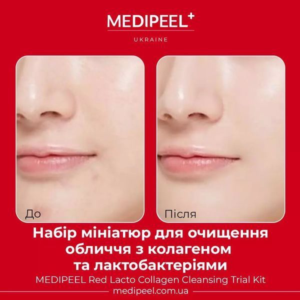 Двухэтапный набор средств для чувствительной и проблемной кожи с центеллой Medi-Peel Red Lacto Collagen 3000 Shot Serum 2 Step Mask 1580 фото