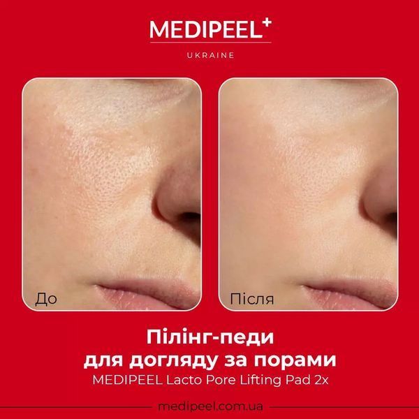 Пилинговые пэды для ухода за порами MEDIPEEL Lacto Pore Lifting Pad 2x 2495 фото