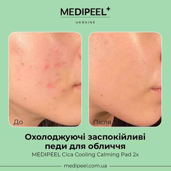 Охолоджуючі заспокійливі педи для обличчя MEDIPEEL Cica Cooling Calming Pad 2x 2496 фото