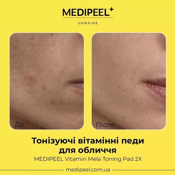 Тонізуючі вітамінні педи для обличчя Medi-Peel Vitamin Mela Toning Pad 2x 2497 фото