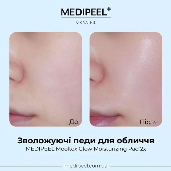 Увлажняющие пэды для лица Medi-Peel Mooltox Glow Moisturizing Pad 2x 2498 фото
