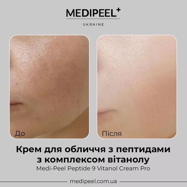 Пептидный крем для лица с ниацинамидом Medi-Peel Peptide 9 Vitanol Cream Pro 50ml 846 фото