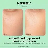 Патчі заспокійливі з компплексом пептидів Medi-Peel Hyaluron Cica Peptide 9 Ampoule Eye Patch 0051 фото
