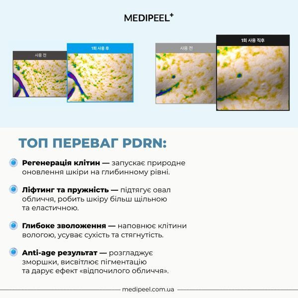 Капсульный гель-крем для лица Medi-Peel Phyto EX PDRN Lifting Shot Drop Gel Cream 2508 фото