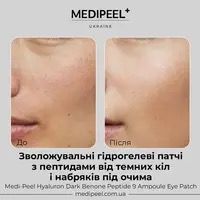 Антивозрастные патчи с комплексом пептидов Medi-Peel Hyaluron Dark Benone Peptide Eye Patch 0053 фото