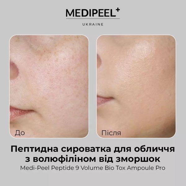 Пептидна сироватка для обличчя проти зморшок Medi peel Peptide 9 Volume Bio Tox Ampoule PRO 2507 фото