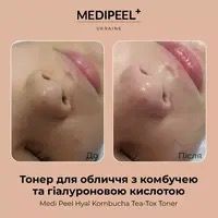 Увлажняющий тонер для лица с комбучей Medi-Peel Hyal Kombucha Tea Tox 0085 фото