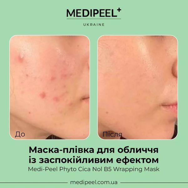 Маска-плёнка для лица с успокаивающим эффектом MEDIPEEL Phyto Cica Nol B5 Wrapping Mask 2313 фото