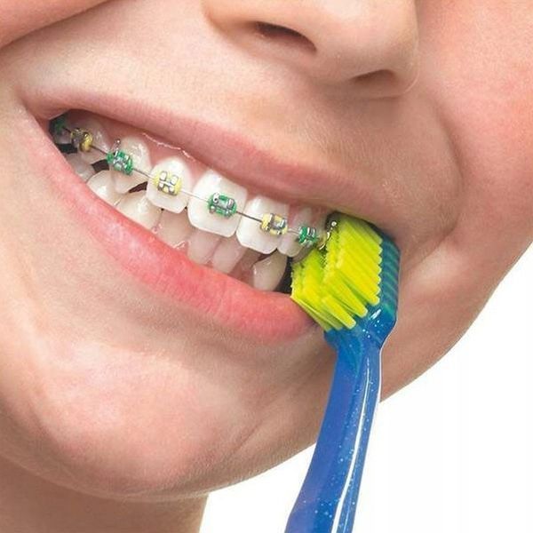 Ортодонтическая щетка с углублением Curaprox CS 5460 Ortho 1302 фото