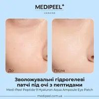 Зволожуючі патчі з гіалуроновою кислотою Medi-Peel Hualuron Aqua  0086 фото