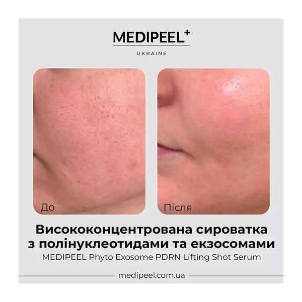 Антивікова сироватка для обличчя Medi-Peel Phyto Exosome Phyto Exosome PDRN Lifting Shot Serum, 50ml 1578 фото