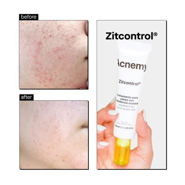 Крем для проблемной кожи Acnemy Zitcontrol Treatment For Acne-Prone Skin 2126 фото
