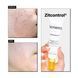 Крем для проблемной кожи Acnemy Zitcontrol Treatment For Acne-Prone Skin 2126 фото 8