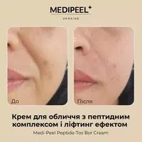 Антивіковий крем для обличчя Medi-Peel Peptide-Tox Bor Cream  109 фото