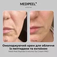 Антивозрастной крем с пептидами и эктоином Medi-Peel Peptide 9 Volume Tox Cream Pro 0024 фото