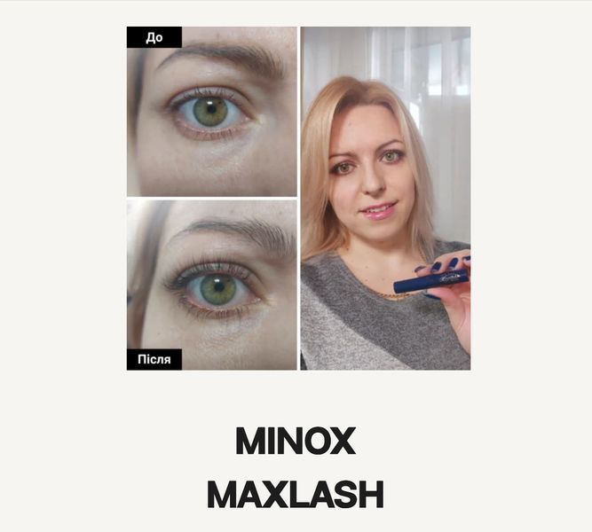 Сыворотка  для роста ресниц и бровей Minox Maxlash 525 фото