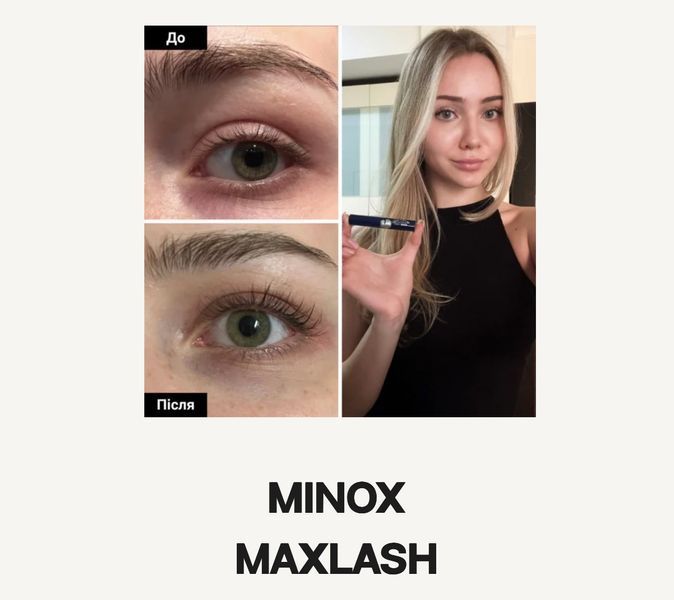 Сыворотка  для роста ресниц и бровей Minox Maxlash 525 фото