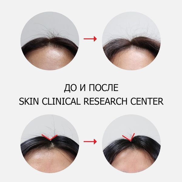 Шампунь против выпадения волос Dr.FORHAIR Folligen Shampoo, 300мл 758 фото