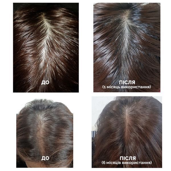Шампунь против выпадения волос Dr.FORHAIR Folligen Shampoo, 300мл 758 фото
