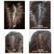 Шампунь против выпадения волос Dr.FORHAIR Folligen Shampoo, 300мл 758 фото 6